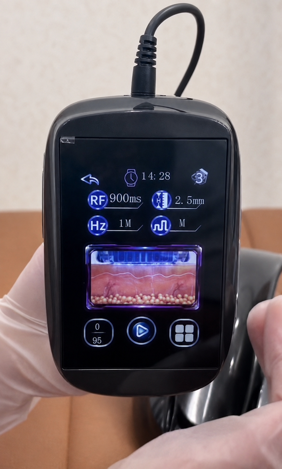 MBS DermaPure RF-Mikroneedling System